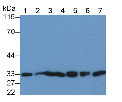 Monoclonal Antibody to Nerve Growth Factor (NGF)