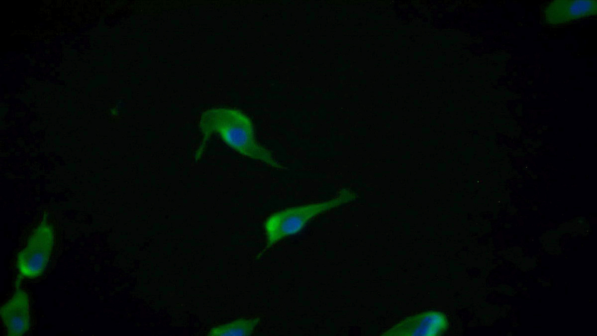 Monoclonal Antibody to Nerve Growth Factor (NGF)