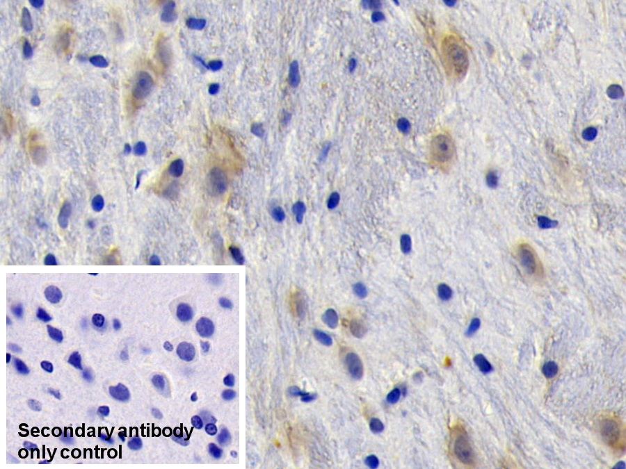 Monoclonal Antibody to Nerve Growth Factor (NGF)