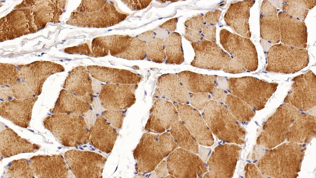 Monoclonal Antibody to Creatine Kinase, Muscle (CKM)