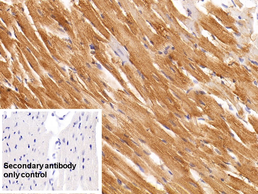 Monoclonal Antibody to Creatine Kinase, Muscle (CKM)