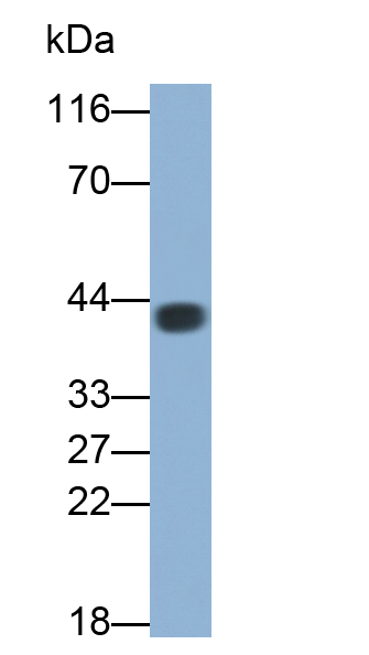 Monoclonal Antibody to Creatine Kinase, Muscle (CKM)