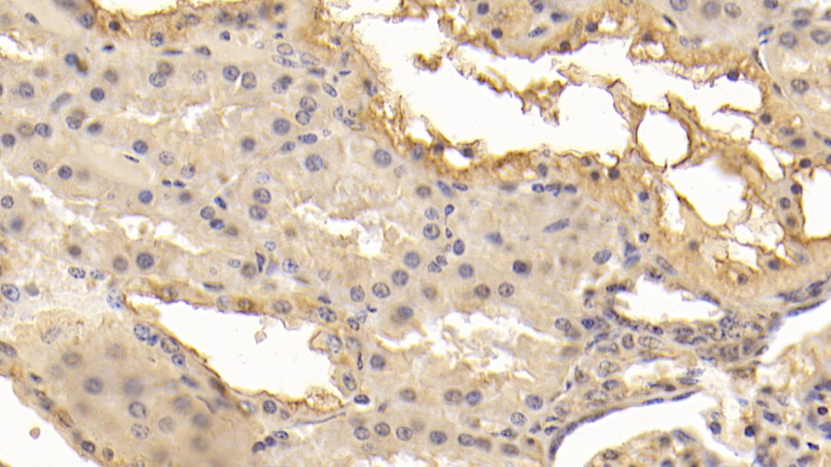 Monoclonal Antibody to Superoxide Dismutase 3, Extracellular (SOD3)