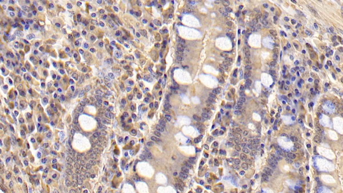 Monoclonal Antibody to Superoxide Dismutase 3, Extracellular (SOD3)