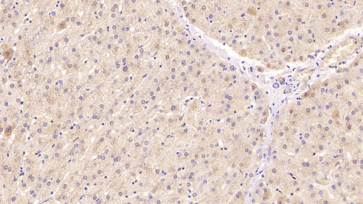 Monoclonal Antibody to Superoxide Dismutase 3, Extracellular (SOD3)