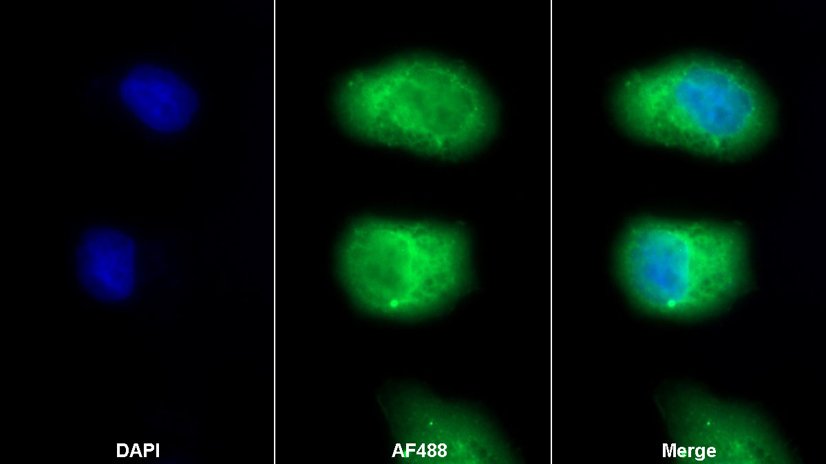 Monoclonal Antibody to Stem Cell Factor Receptor (SCFR)