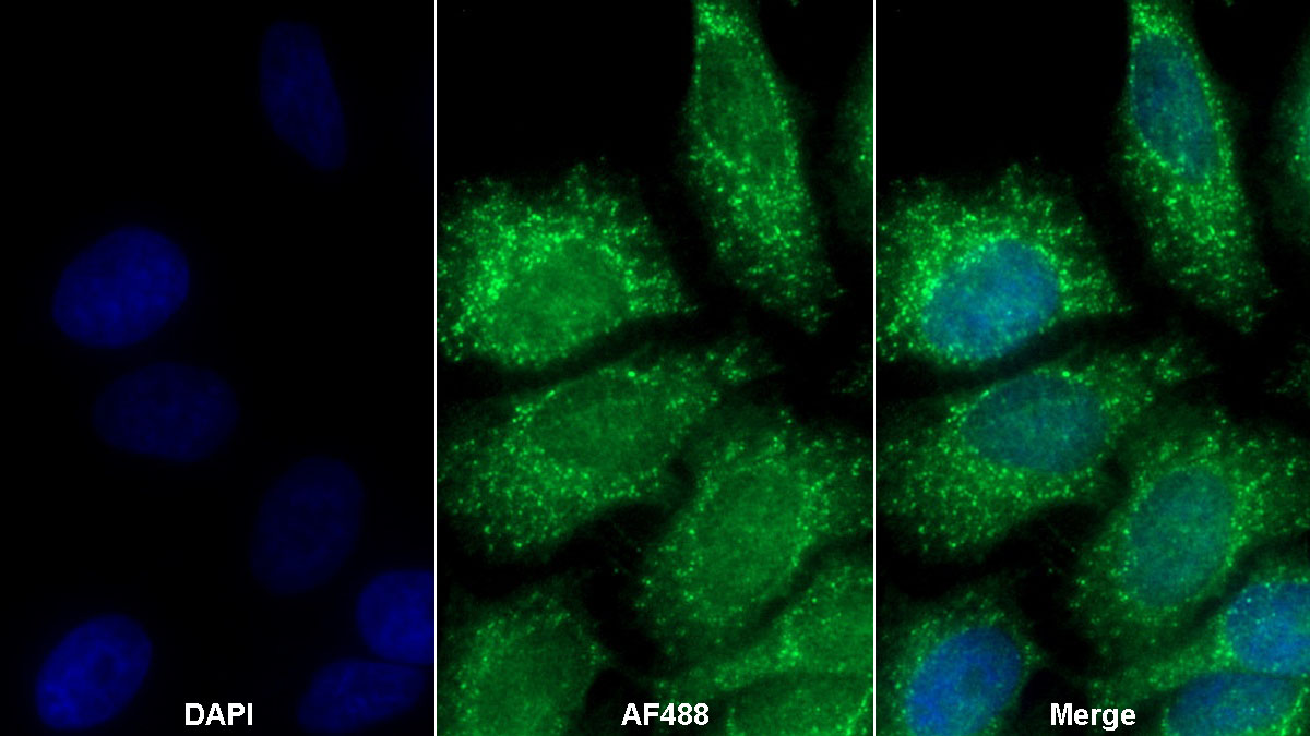 Monoclonal Antibody to Tissue Inhibitors Of Metalloproteinase 3 (TIMP3)