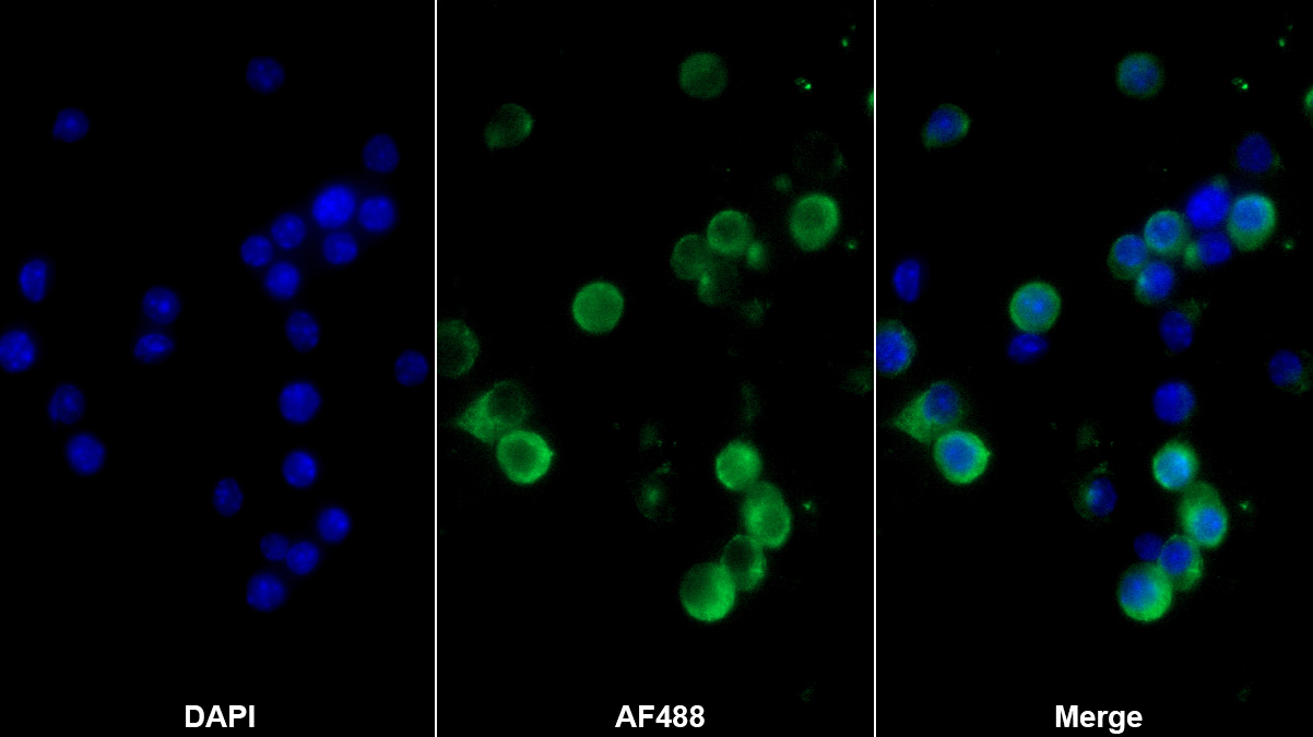 Monoclonal Antibody to Tumor Necrosis Factor Alpha (TNFa)