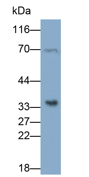 Monoclonal Antibody to Prostate Specific Antigen (PSA)