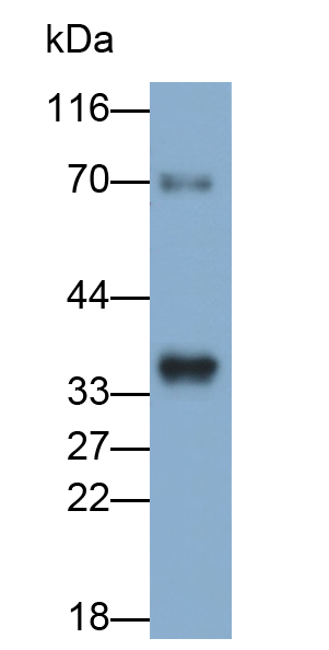 Monoclonal Antibody to Prostate Specific Antigen (PSA)