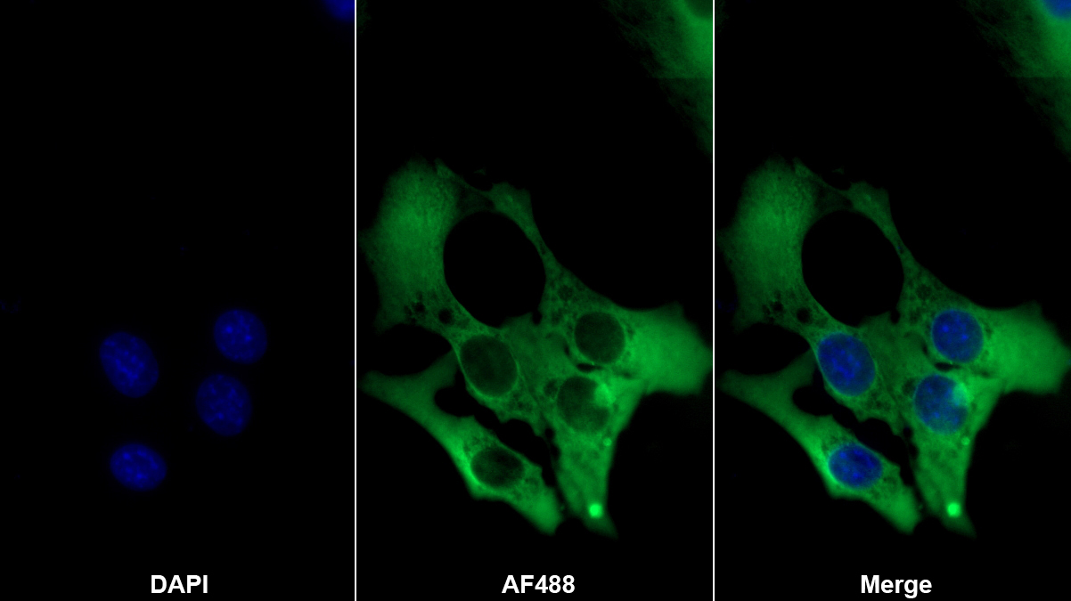 Monoclonal Antibody to Alpha-Fetoprotein (AFP)