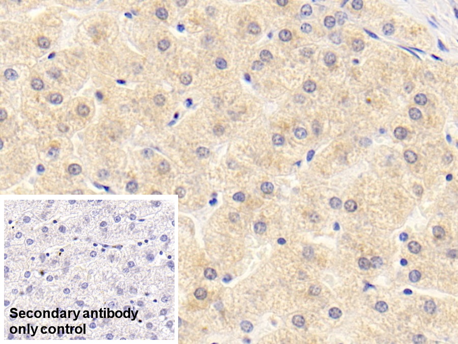 Monoclonal Antibody to Alpha 2-Antiplasmin (a2PI)