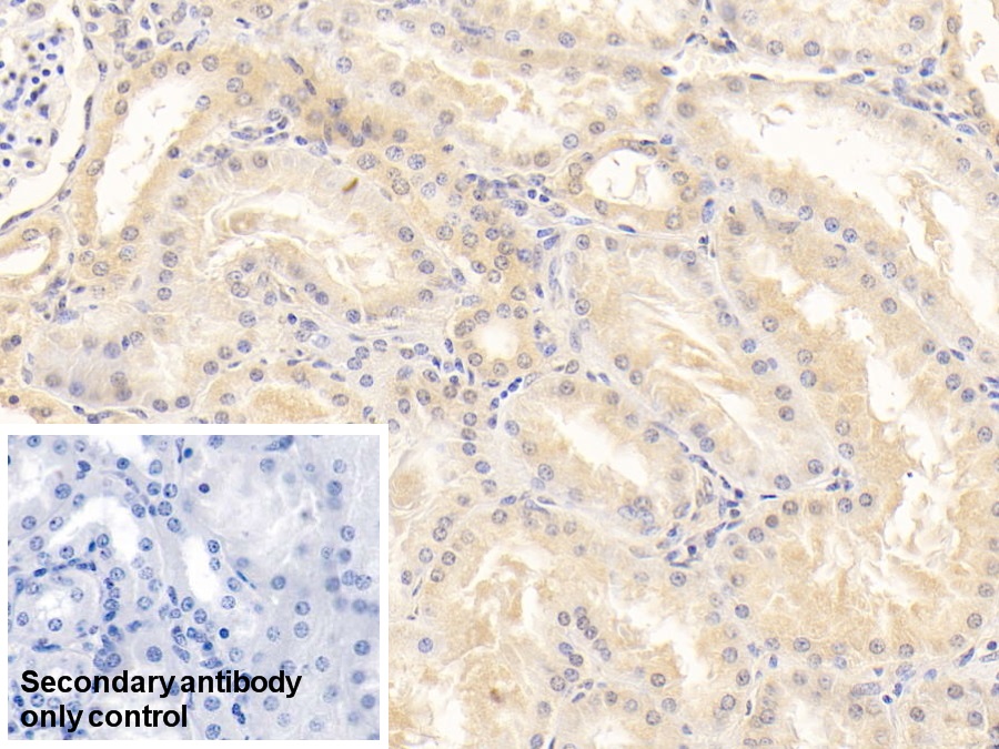 Monoclonal Antibody to Alpha 2-Antiplasmin (a2PI)