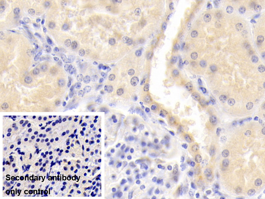 Monoclonal Antibody to Alpha 2-Antiplasmin (a2PI)