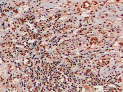 Monoclonal Antibody to Ubiquitin (Ub)