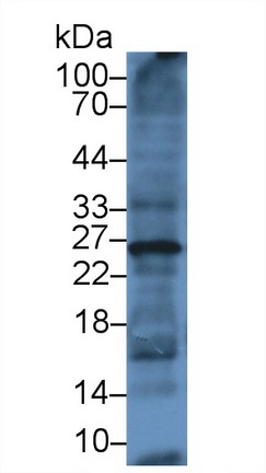 Monoclonal Antibody to Ubiquitin (Ub)