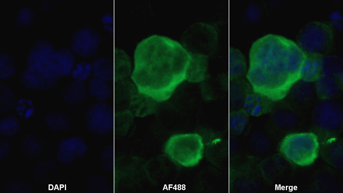 Monoclonal Antibody to Pepsinogen A (PGA)