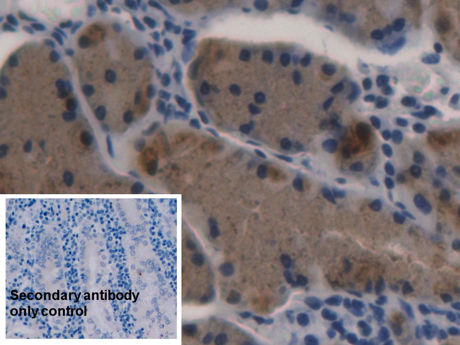 Monoclonal Antibody to Pepsinogen A (PGA)