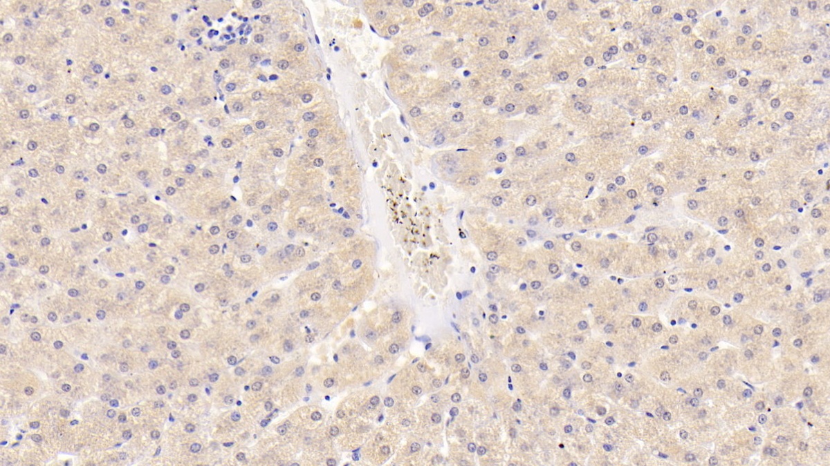 Monoclonal Antibody to Alanine Aminotransferase (ALT)