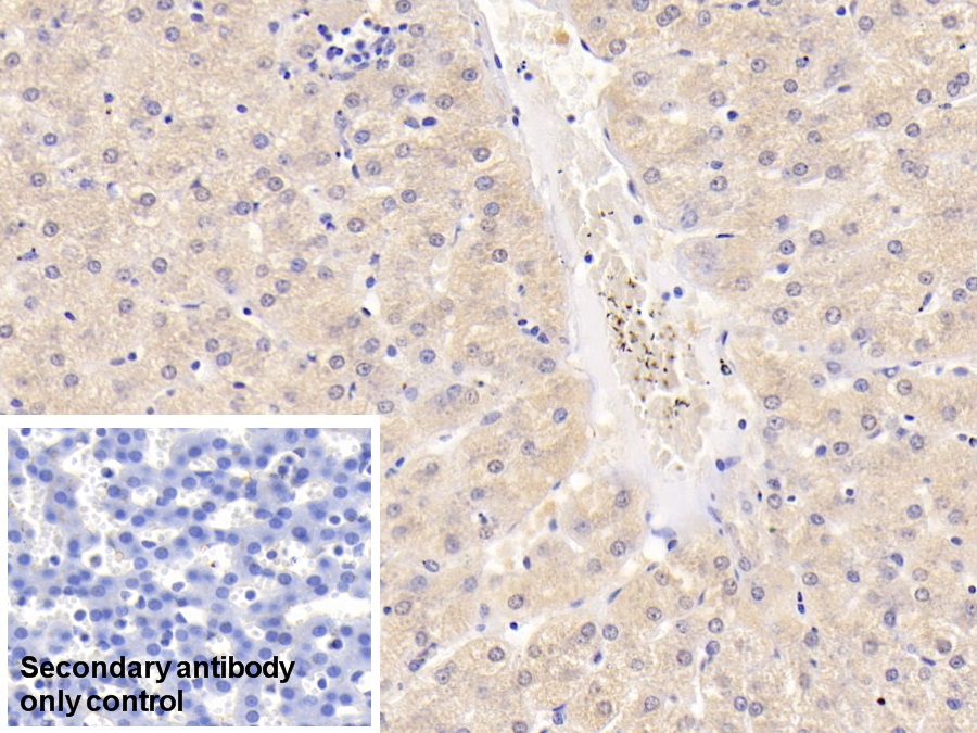 Monoclonal Antibody to Alanine Aminotransferase (ALT)