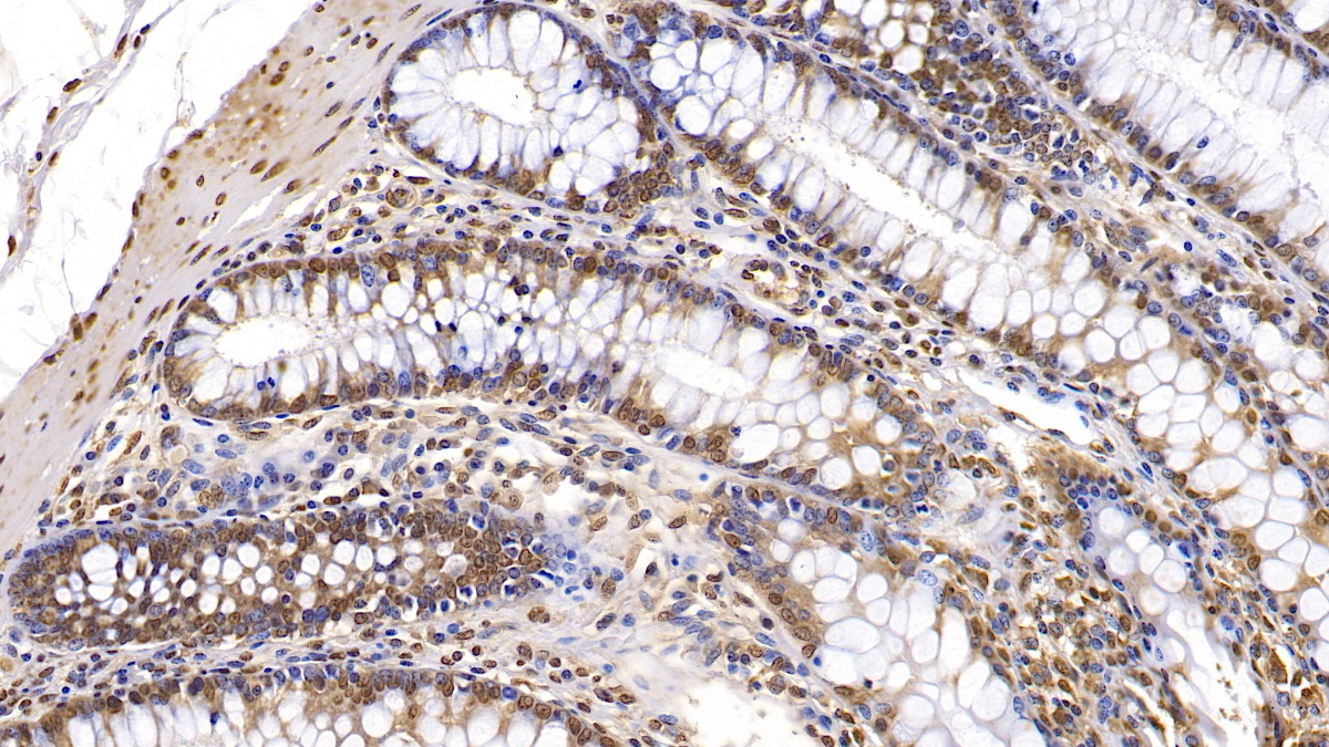 Monoclonal Antibody to Interferon Beta (IFNb)