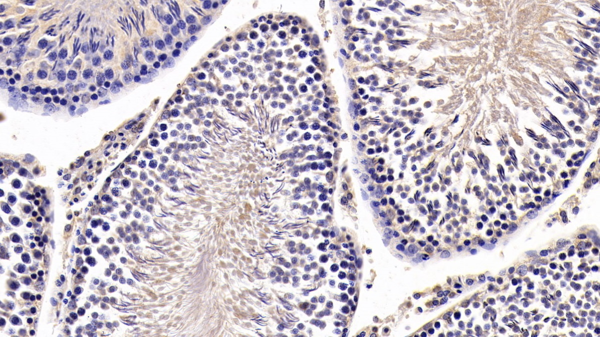 Monoclonal Antibody to Anti-Mullerian Hormone (AMH)