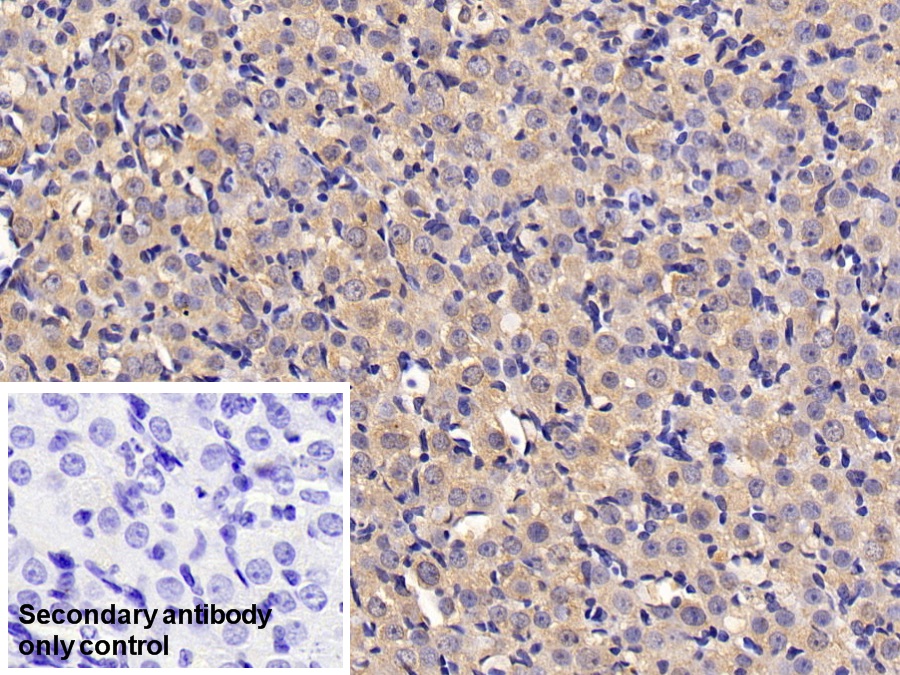 Monoclonal Antibody to Anti-Mullerian Hormone (AMH)