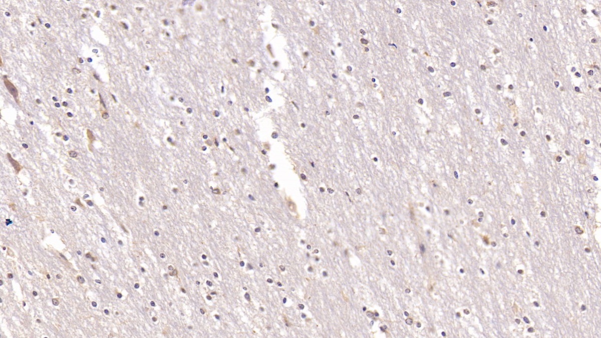 Monoclonal Antibody to Annexin V (ANXA5)