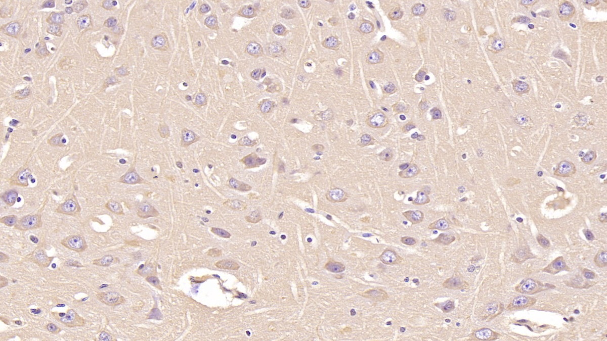 Monoclonal Antibody to Annexin V (ANXA5)