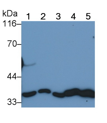 Monoclonal Antibody to Annexin V (ANXA5)