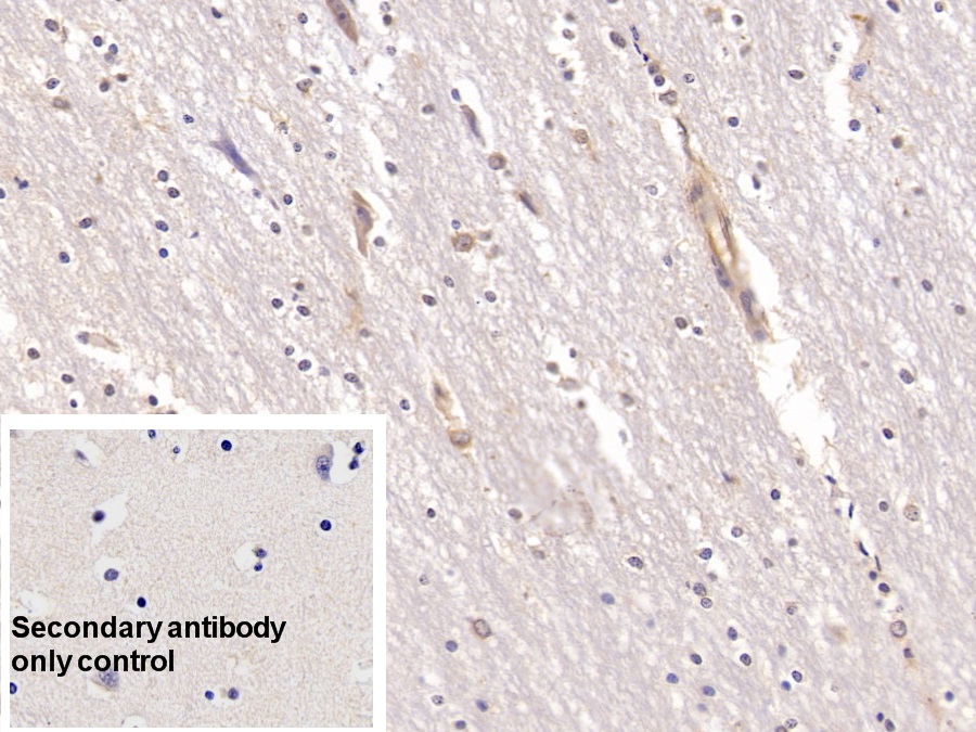 Monoclonal Antibody to Annexin V (ANXA5)