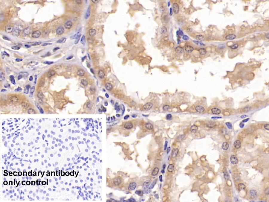 Monoclonal Antibody to Annexin V (ANXA5)