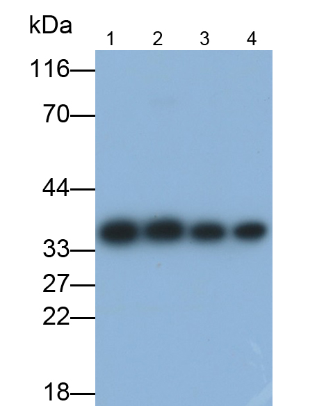 Monoclonal Antibody to Annexin V (ANXA5)