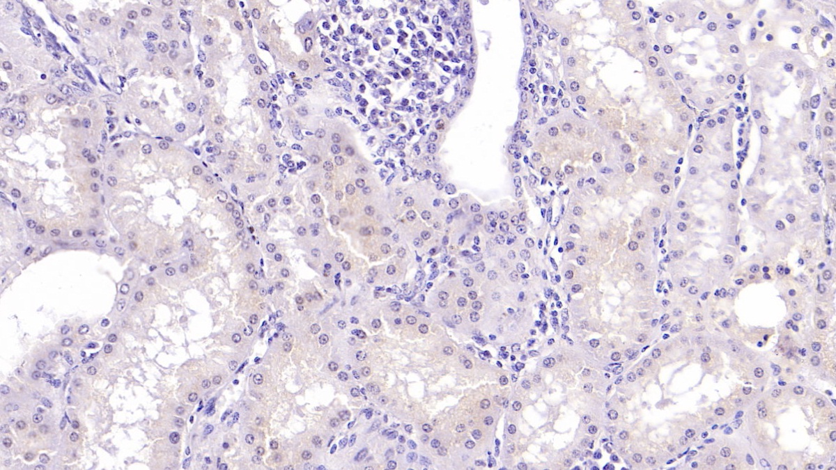 Monoclonal Antibody to Beta-2-Microglobulin (b2M)