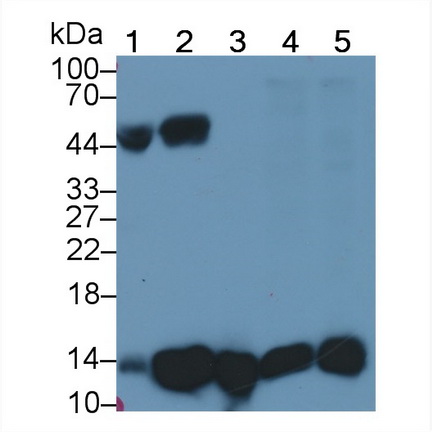 Monoclonal Antibody to Beta-2-Microglobulin (b2M)