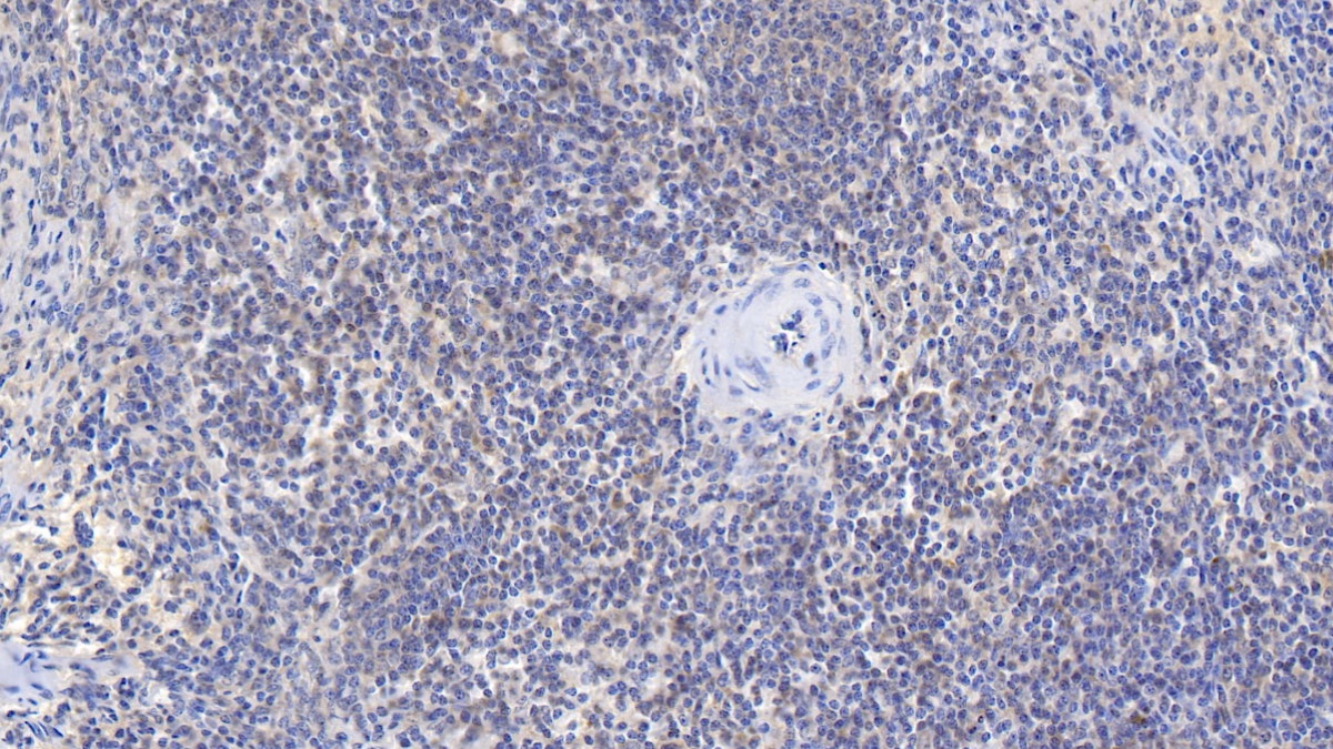 Monoclonal Antibody to Beta-2-Microglobulin (b2M)