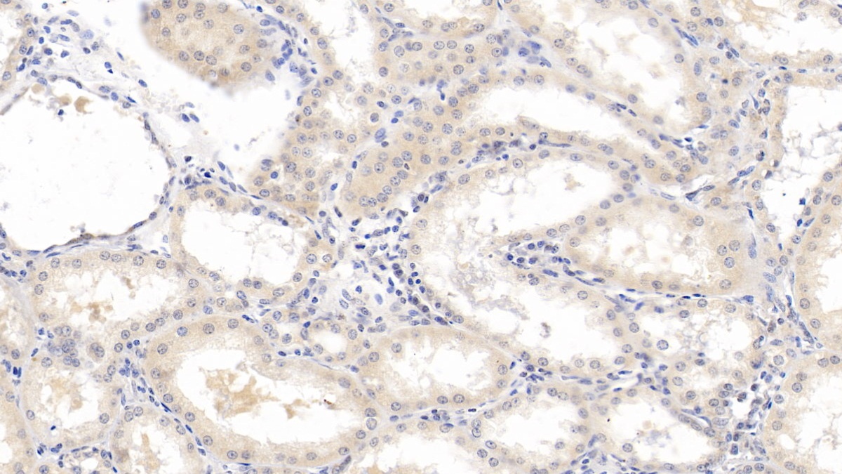 Monoclonal Antibody to Beta-2-Microglobulin (b2M)