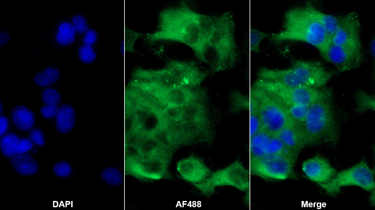 Monoclonal Antibody to Beta-2-Microglobulin (b2M)