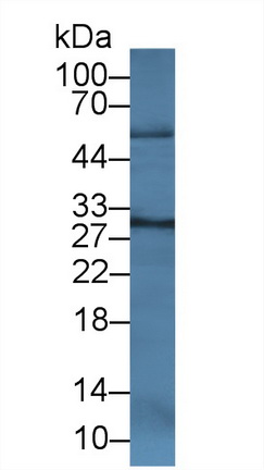 Monoclonal Antibody to Cathepsin K (CTSK)