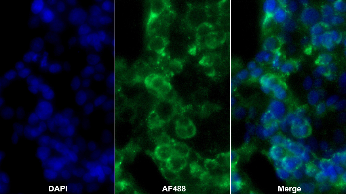 Monoclonal Antibody to Cathepsin K (CTSK)