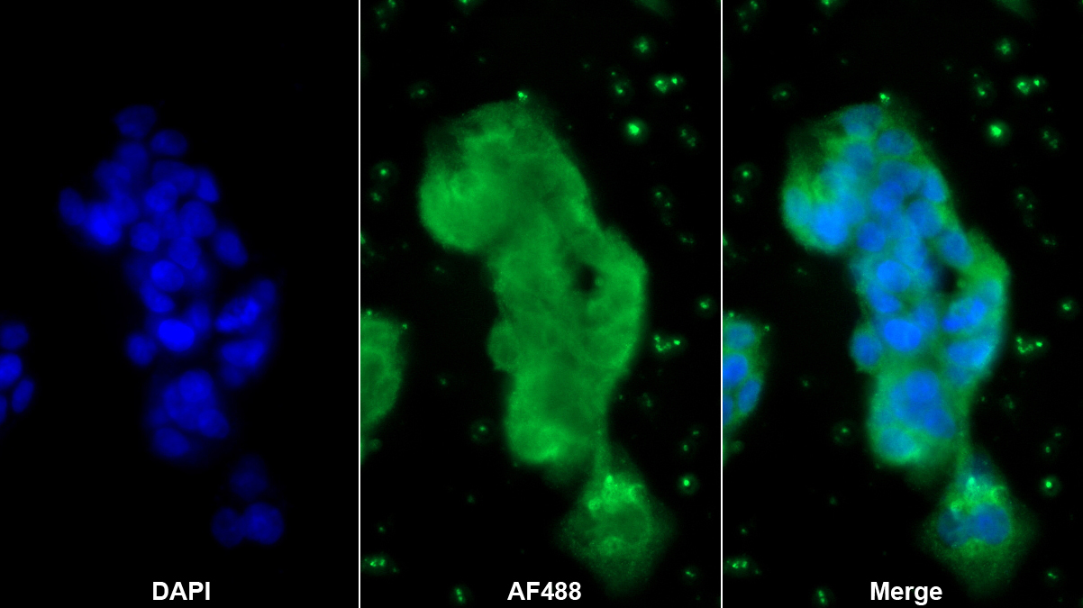 Monoclonal Antibody to Cathepsin K (CTSK)