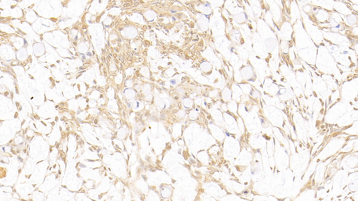 Monoclonal Antibody to Galectin 3 (GAL3)