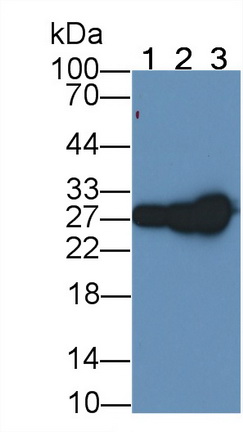 Monoclonal Antibody to Galectin 3 (GAL3)