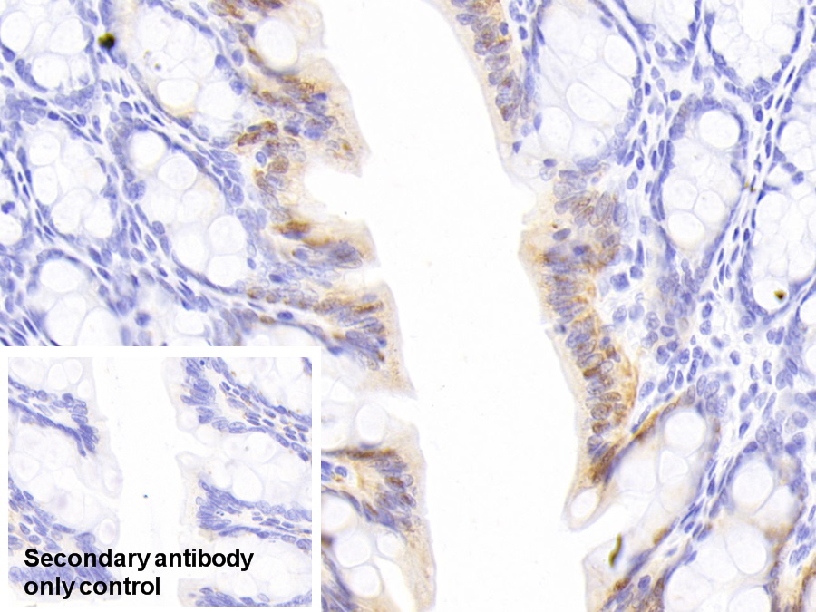 Monoclonal Antibody to Galectin 3 (GAL3)