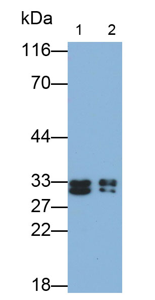 Monoclonal Antibody to Galectin 3 (GAL3)