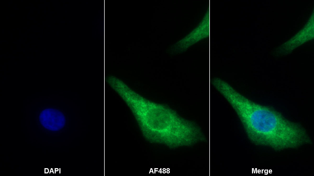 Monoclonal Antibody to Galectin 8 (GAL8)