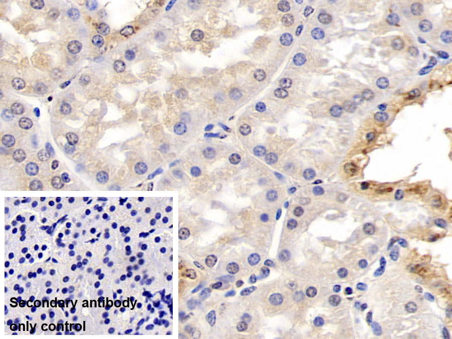 Monoclonal Antibody to Apolipoprotein H (APOH)