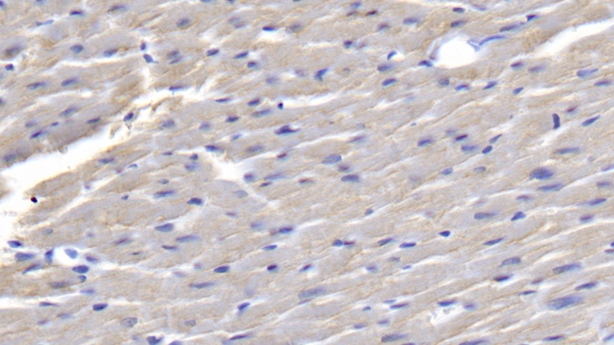 Monoclonal Antibody to Galectin 1 (GAL1)