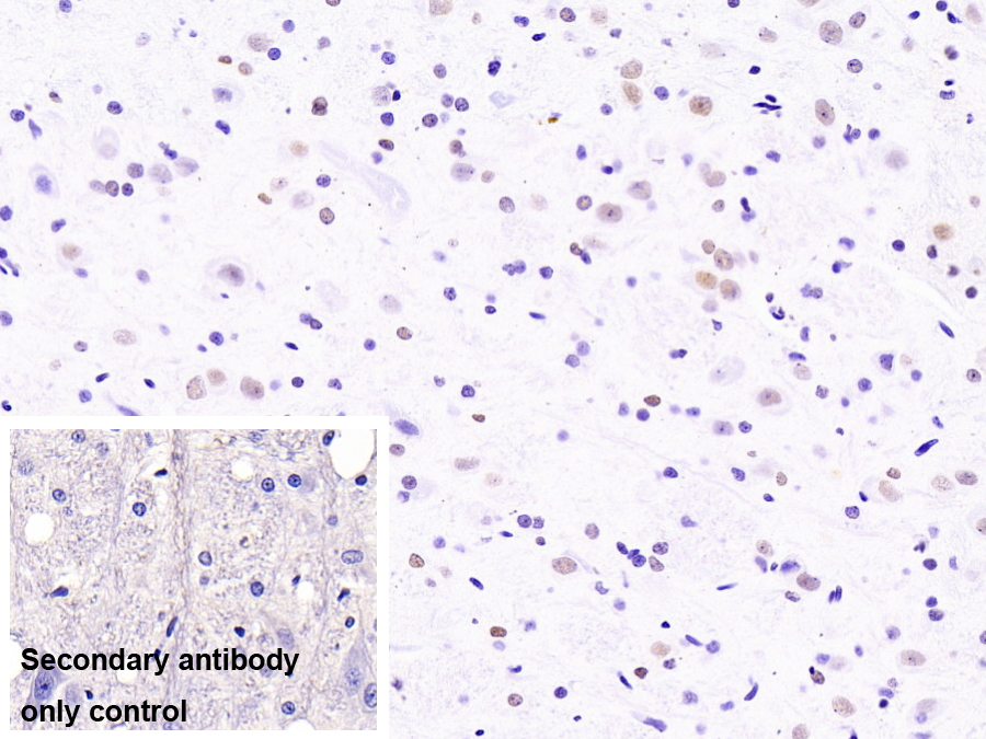Monoclonal Antibody to Heterogeneous Nuclear Ribonucleoprotein A2/B1 (HNRPA2B1)