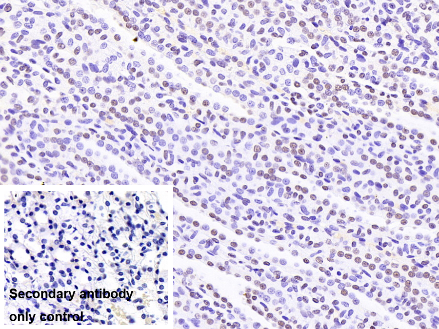 Monoclonal Antibody to Heterogeneous Nuclear Ribonucleoprotein A2/B1 (HNRPA2B1)